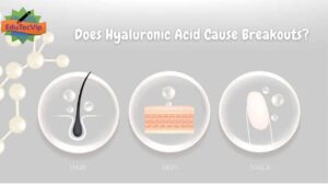 Hyaluronic Acid Cause Breakouts